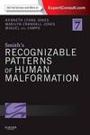 Smith's Recognizable Patterns of Human Malformation