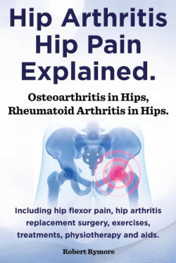 Hip Arthritis, Hip Pain Explained. Osteoarthritis in Hips, Rheumatoid Arthritis in Hips. Including Hip Arthritis Surgery, Hip Flexor Pain, Exercises,