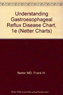 Understanding Gastroesophageal Reflux Disease Chart