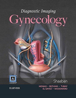 Diagnostic Imaging: Gynecology