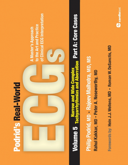 Podrid?s Real-World ECGs