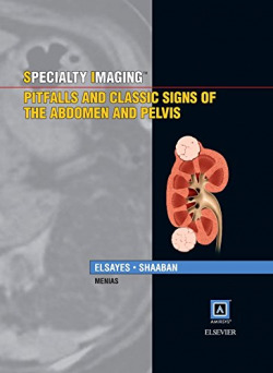 Specialty Imaging: Pitfalls and Classic Signs of the Abdomen and Pelvis