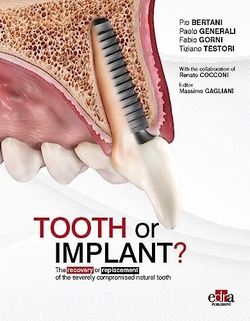 TOOTH OR IMPLANT THE RECOVERY OR REPLACEMENT OF THE SEVERE