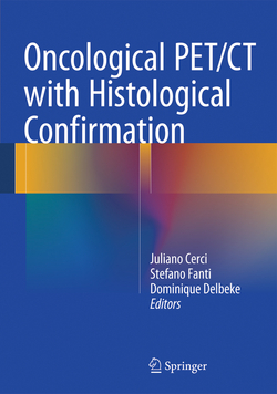 ONCOLOGIVAL PET/CT WITH HISTOLOGIVAL CONFIRMATION