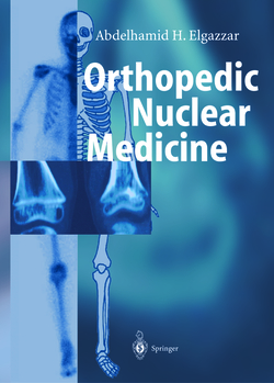 ORTHOPEDIC NUCLEAR MEDICINE