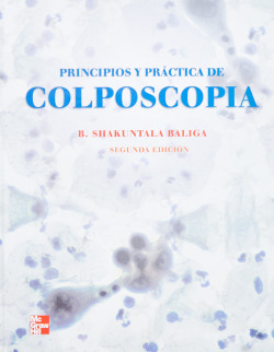 Principios y practica de colposcopia