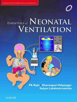 Essentials of neonatal ventilation