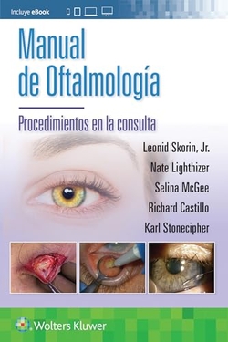 MANUAL DE OFTALMOLOGIA