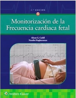 Monitorización de la Frecuencia Cardiaca Fetal