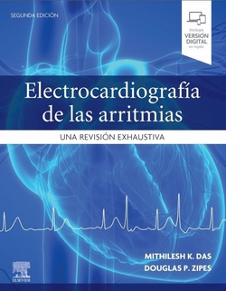 Electrocardiografía de las arritmias