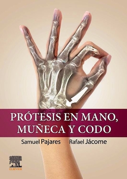 Protesis en mano muñeca y codo