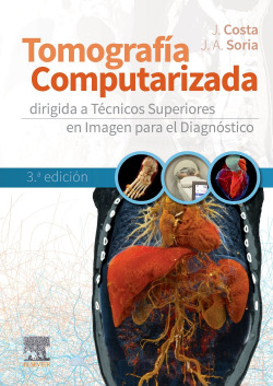 Tomografia computarizada dirigida a tecnicos sueriores