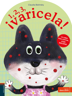 1, 2, 3 ¡VARICELA!