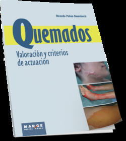 QUEMADOS. VALORACION Y CRITERIO