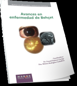 Avances en enfermedad de Behcet