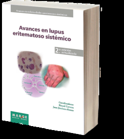 Avances en lupus eritematoso sistémico