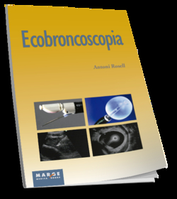 ECOBRONCOSCOPIA