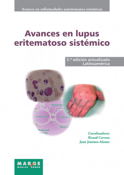 Avances en lupus eritematoso sistémico - Latinoamérica