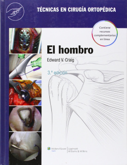 EL HOMBRO.