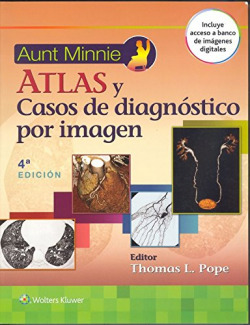 Aunt Minnie's. Atlas y casos de diagnóstico por imagen