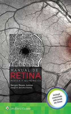 Manual de retina