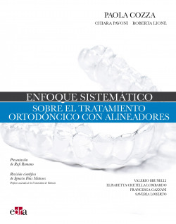 Enfoque sistemático sobre el tratamiento ortodóncico con alineadores