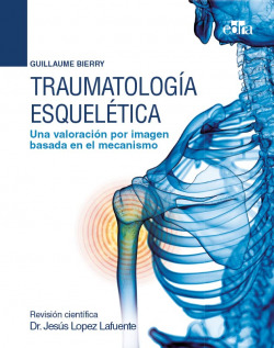 Traumatología esquelética Una valoración por imagen basada en el mecanismo