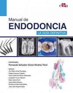Manual de endodoncia. La guía definitiva