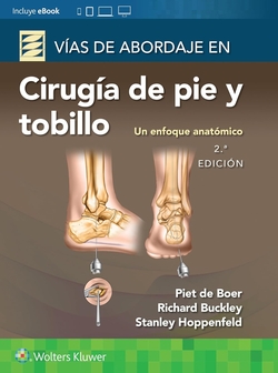 Vías de abordaje de cirugía de pie y tobillo