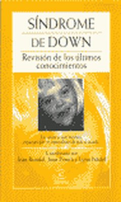 El síndrome de Down