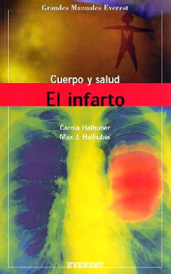 El Infarto