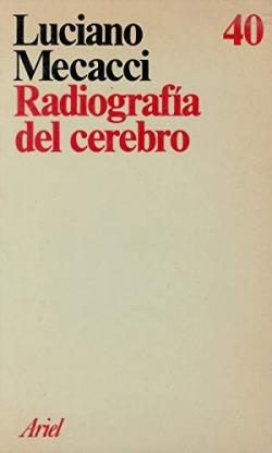 RADIOGRAFIA DEL CEREBRO