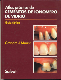ATLAS PRACTICO DE CEMENTOS DE IONOMERO DE VIDRIO. GUIA CLINI