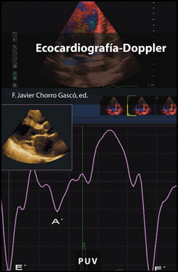 Ecocargiografia doppler