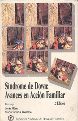 SINDROME DE DOWN
