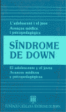SINDROME DE DOWN