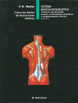 Sistema musculosquelético. Trastornos del desarrollo, tumores, enfermedades reumáticas y reemplazami