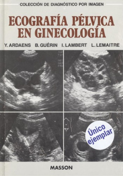 Ecografía pélvica en ginecología