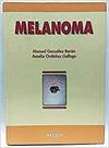 Melanoma