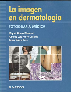 LA IMAGEN EN DERMATOLOGIA, FOTOGRAFIA MEDICA