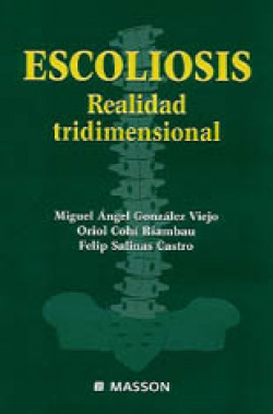 ESCOLIOSIS. REAL TRI.