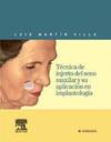 Técnica de injerto del seno maxilar y su aplicación en implantología