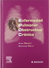 Enfermedad pulmonar obstructiva crónica
