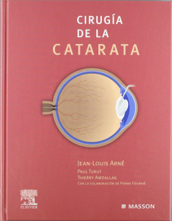Cirugía de la catarata