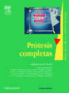 Prótesis completas