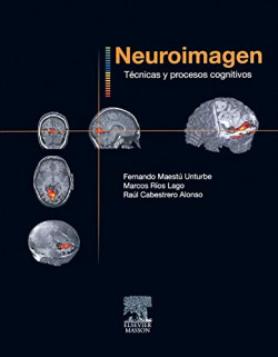 Neuroimagen