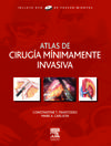 Atlas de cirugía mínimamente invasiva + DVD-ROM