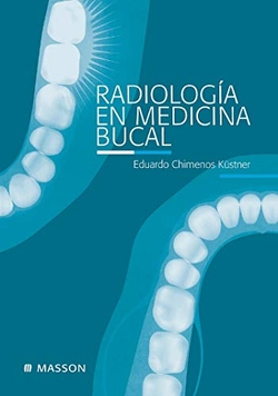 Radiología en medicina bucal