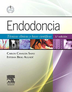 Endodoncia: técnicas clínicas y bases científicas