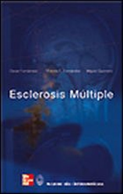 Esclerosis Múltiple